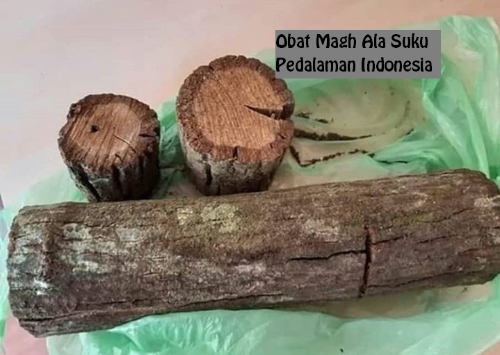 Obat Maag Ala Suku Pedalaman Indonesia